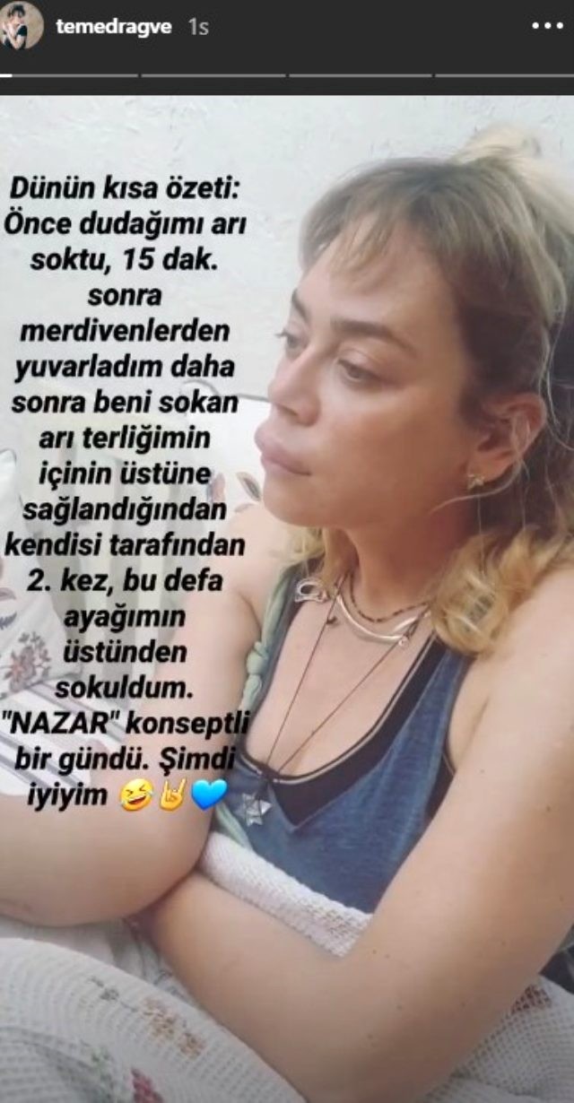 Məşhur aktrisa tanınmaz halda - FOTO