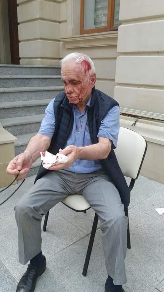 Rəhim Qazıyevin xəsarət alması ilə bağlı cinayət işi başlanılıb - YENİLƏNİB (FOTOLAR)
