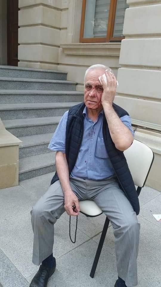 Rəhim Qazıyevin xəsarət alması ilə bağlı cinayət işi başlanılıb - YENİLƏNİB (FOTOLAR)