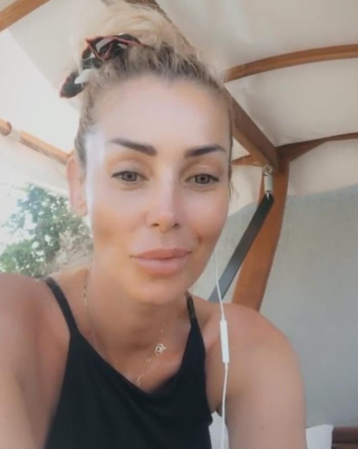 Məşhur müğənni tanınmaz halda - FOTO