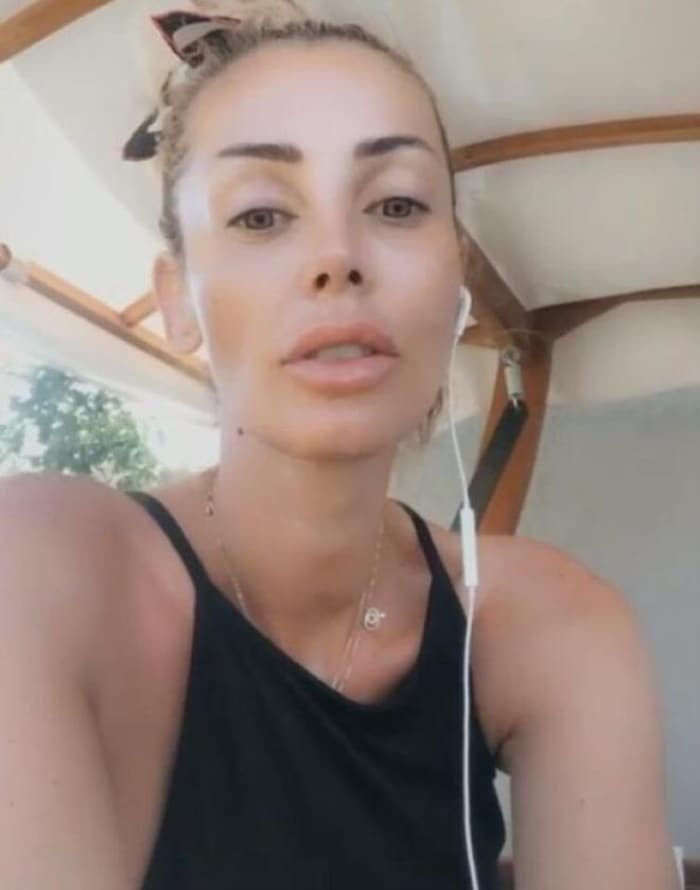 Məşhur müğənni tanınmaz halda - FOTO