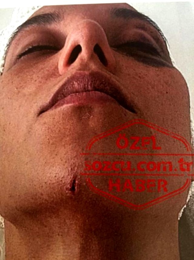 Məşhur aktyorun döydüyü qadının dəhşətli görüntüləri - FOTOLAR