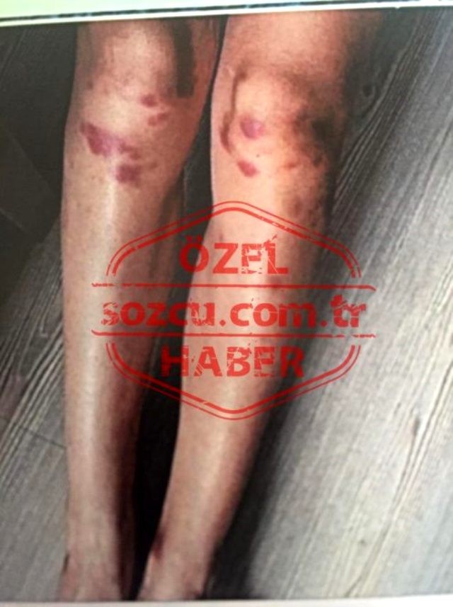 Məşhur aktyorun döydüyü qadının dəhşətli görüntüləri - FOTOLAR