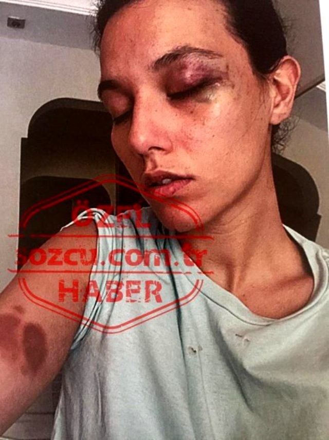 Məşhur aktyorun döydüyü qadının dəhşətli görüntüləri - FOTOLAR