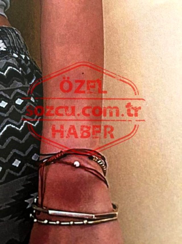 Məşhur aktyorun döydüyü qadının dəhşətli görüntüləri - FOTOLAR