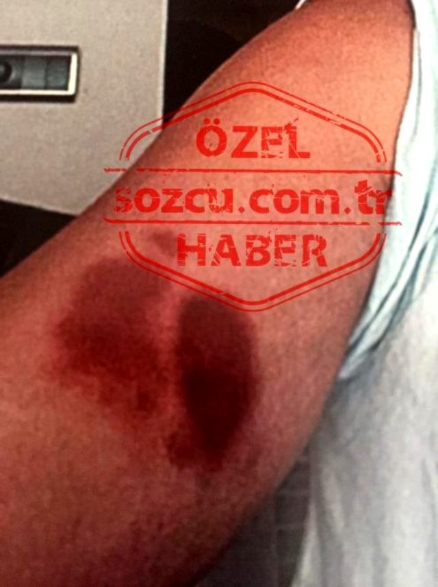 Məşhur aktyorun döydüyü qadının dəhşətli görüntüləri - FOTOLAR