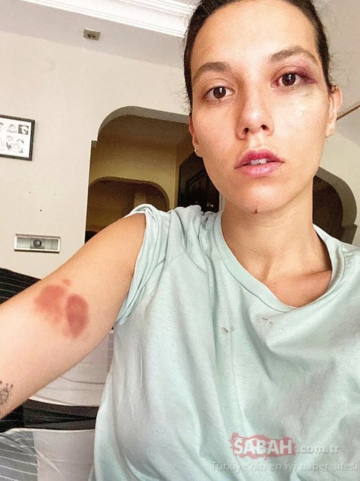 Şiddətdə adı hallanan məşhur evdən qaçdı 