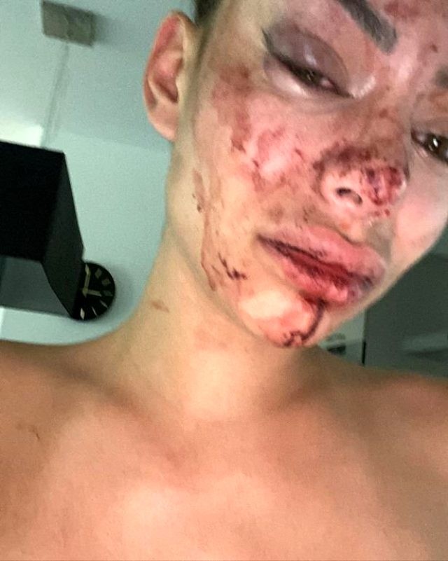 Evində təşkil etdiyi şənlikdə döyüldü - FOTOLAR