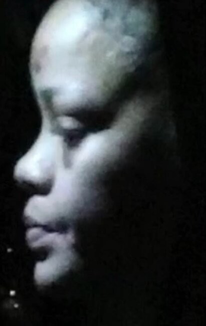 Rihanna döyülüb? - FOTO