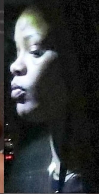 Rihanna döyülüb? - FOTO