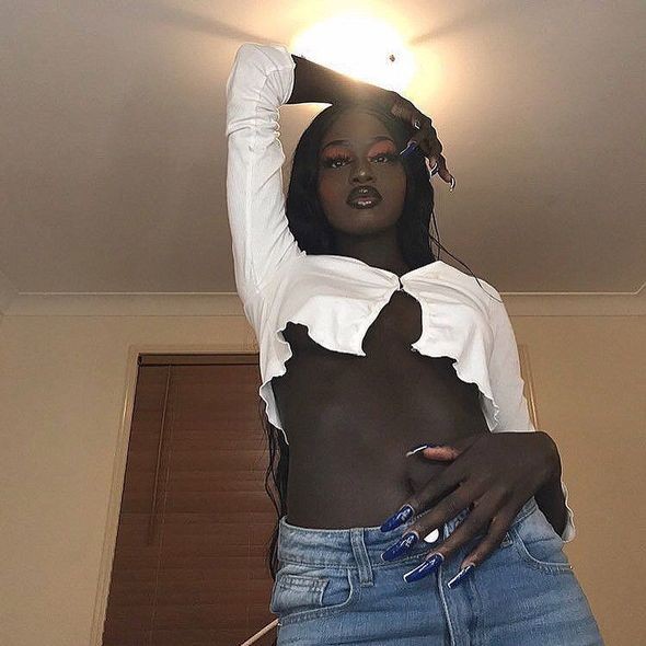 Qeyri-adi dəri rəngi ilə hər kəsi təəccübləndirdi - FOTO