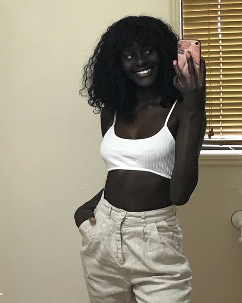 Qeyri-adi dəri rəngi ilə hər kəsi təəccübləndirdi - FOTO