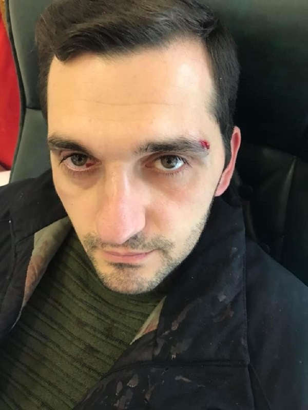 Ermənistanda müxalifətçilərə hücum olundu