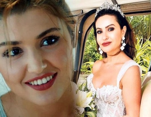 Hande Erçelə bənzəmək istəyən model dişsiz qaldı - FOTO