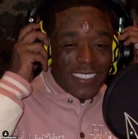 Reper 24 milyonluq almazı alnına yapışdırdı - FOTO