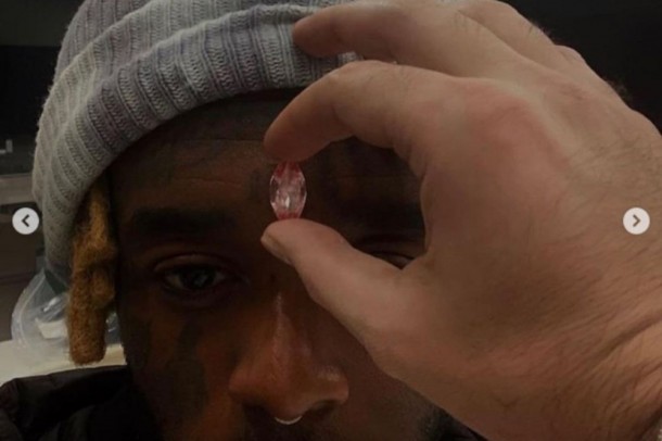 Reper 24 milyonluq almazı alnına yapışdırdı - FOTO