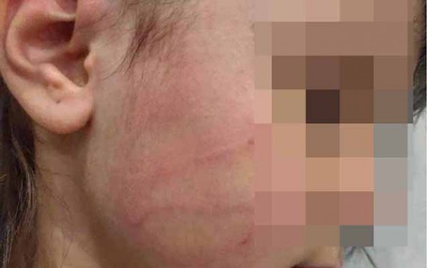 Mətanətin oğlu qızını döyməsi ilə bağlı ittihamlara cavab verdi