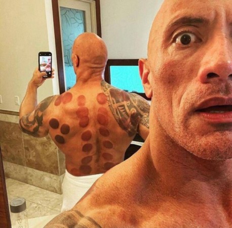 Məşhur aktyor kürəyinə banka qoydurdu - FOTO