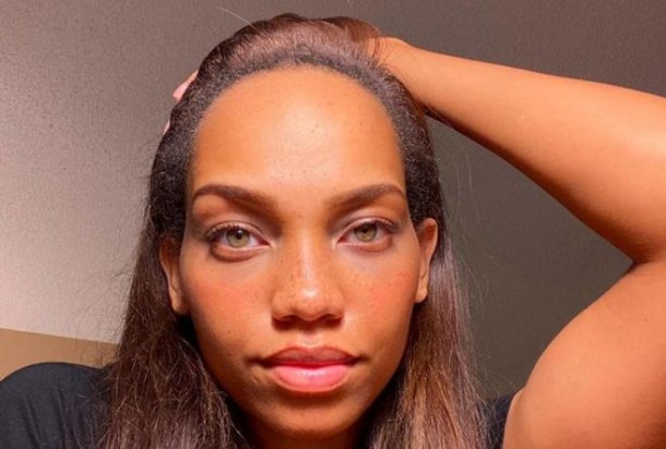 Model alnını əməliyyatla kiçiltdi - FOTOLAR