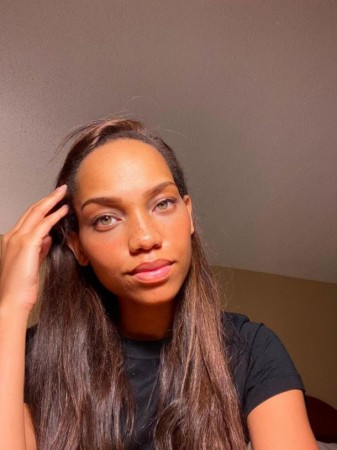 Model alnını əməliyyatla kiçiltdi - FOTOLAR