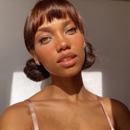 Model alnını əməliyyatla kiçiltdi - FOTOLAR