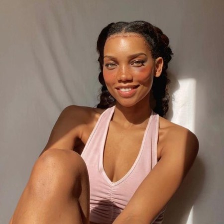 Model alnını əməliyyatla kiçiltdi - FOTOLAR