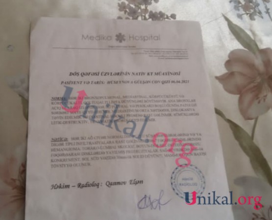 "Rəmişi sağalda bilmədilər, koronavirus diaqnozu qoydular" - Güllü Hüseynova