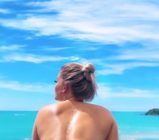 Sevgilisindən ayrılan model intihar etdi -  FOTO