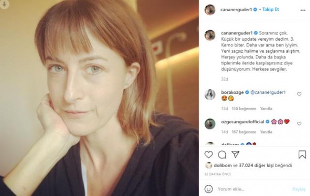 Xərçəngə tutulan aktrisa tanınmaz halda - FOTO