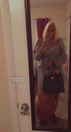 23 yaşlı model hər kəsin təəccübünə səbəb oldu - FOTOLAR