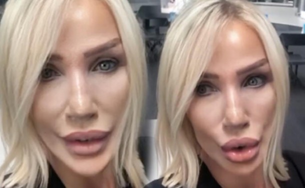 Seda Sayan növbəti dəfə estetik əməliyyat keçirdi - FOTO