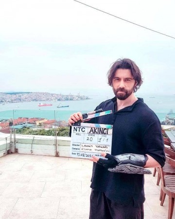 "Akıncı"nın çəkilişlərində alın sümüyü qırıldı - FOTO