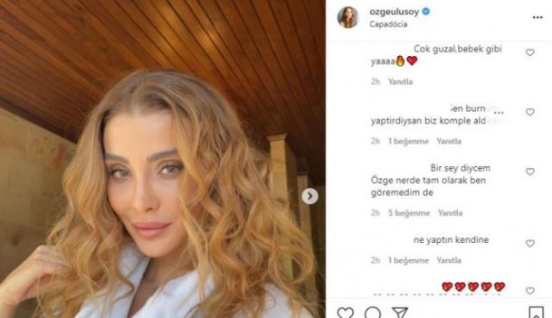 Estetik əməliyyat keçirən aparıcını izləyiciləri tanımadı - FOTO