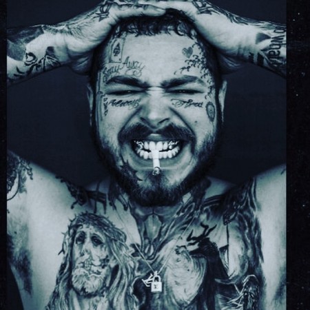 Dişlərinə 2 milyonluq brilyant qoydurdu - FOTO