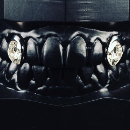 Dişlərinə 2 milyonluq brilyant qoydurdu - FOTO