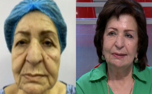 "Oğul itkisi, onkoloji xəstəlik məni bu günə qoydu" - Kübra Əliyeva (FOTO)