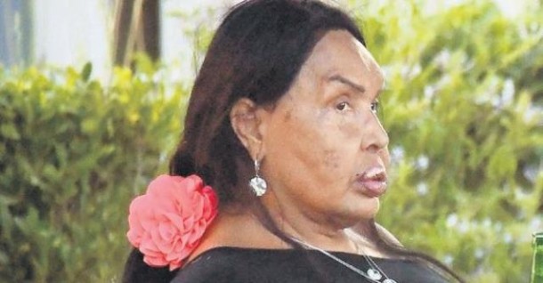 Bülənt Ərsoyun makiyajsız görüntüləri yayıldı (FOTO)