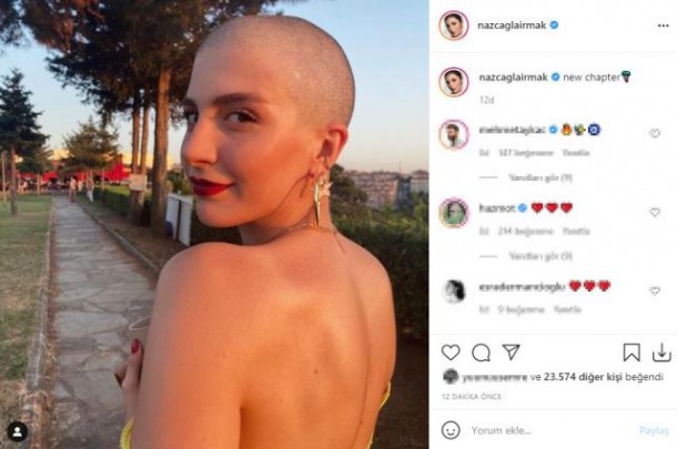 Gənc aktrisa roluna görə keçəl oldu - FOTOLAR