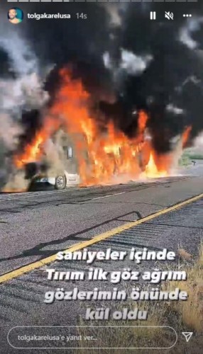 Aktyor düşdüyü qəzanın görüntülərini paylaşdı - FOTOLAR