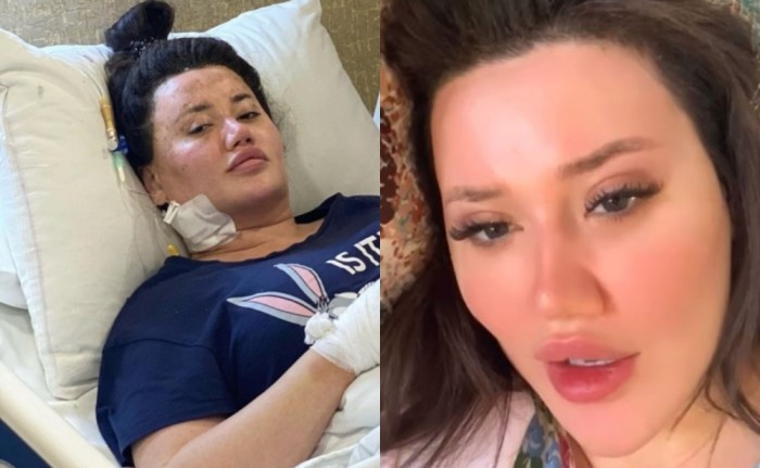 "Allah qohumlarımın bəlasını versin"  - Partlayışda yaralanan Aysel