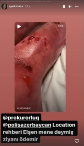 Aysel "Location" klubunun sahibini polisə verdi - FOTOLAR