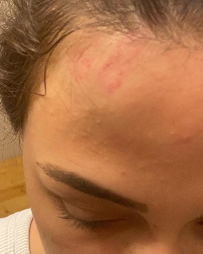 Bloger ərinin voleybolçu sevgilisi tərəfindən döyülüb - İDDİA  (FOTOLAR)