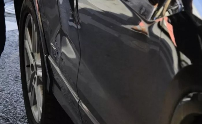 Məşhur türkiyəli aktrisa qəza keçirdi - FOTOLAR