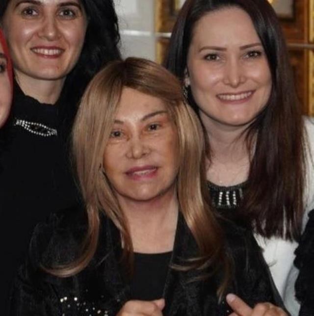 Gözəl görünmək üçün 81 yaşında plastik əməliyyat etdirdi