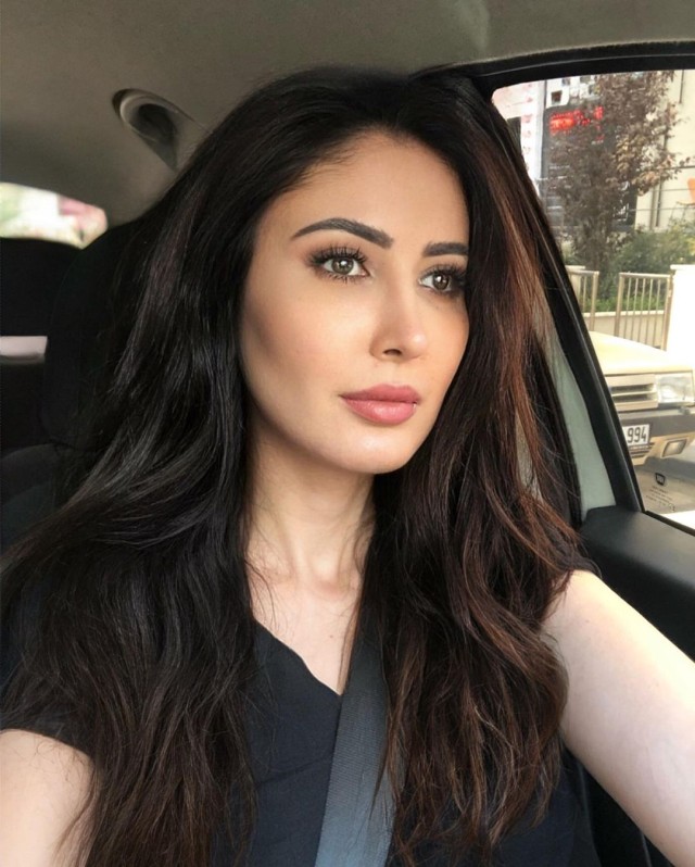 Estetik əməliyyatdan sonra tanınmaz halda - FOTOLAR