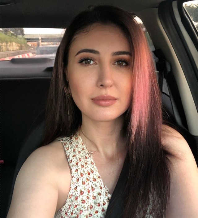 Estetik əməliyyatdan sonra tanınmaz halda - FOTOLAR