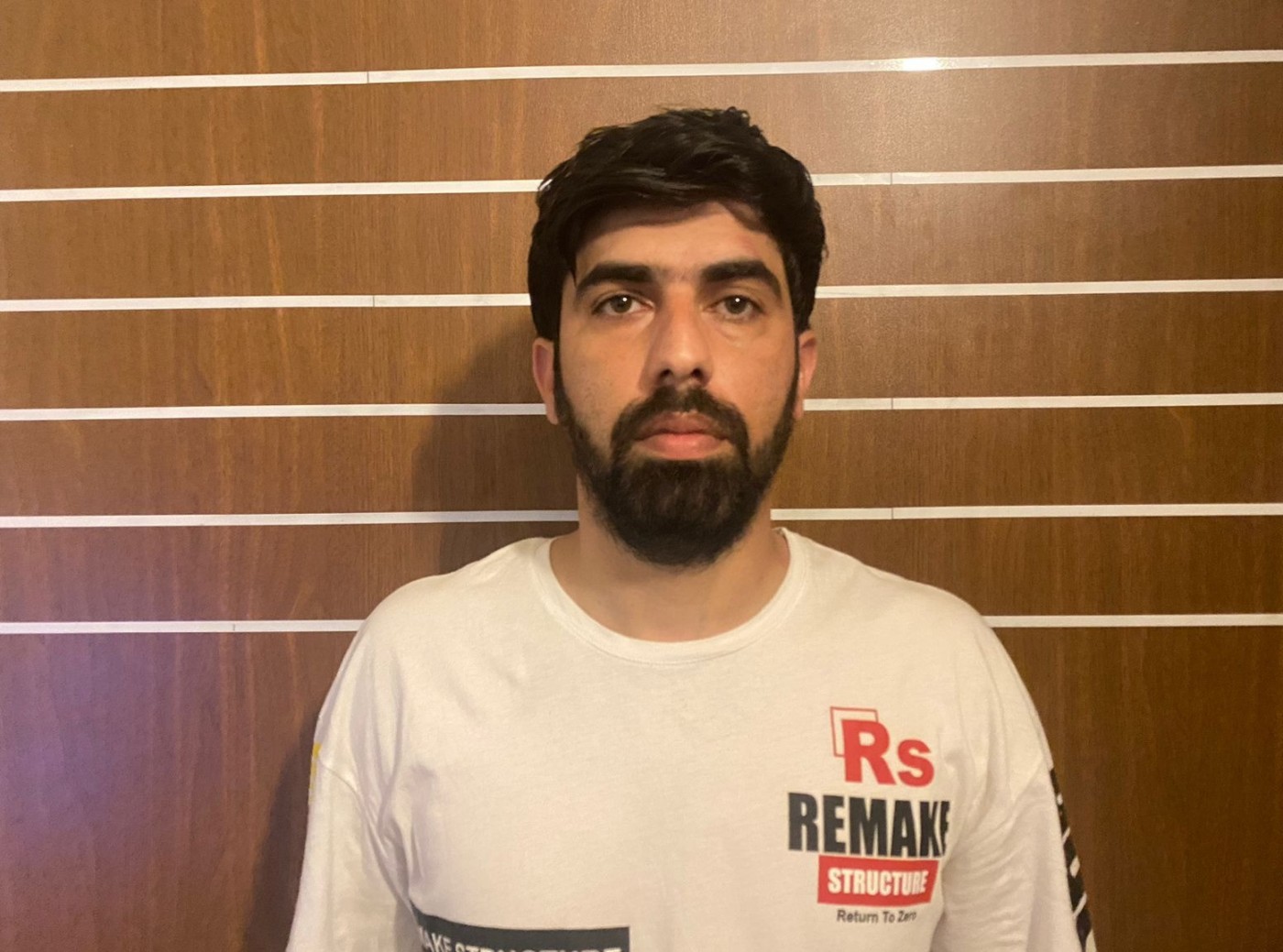 Qəbirləri qazıb qızıl dişləri oğurladılar - FOTOLAR