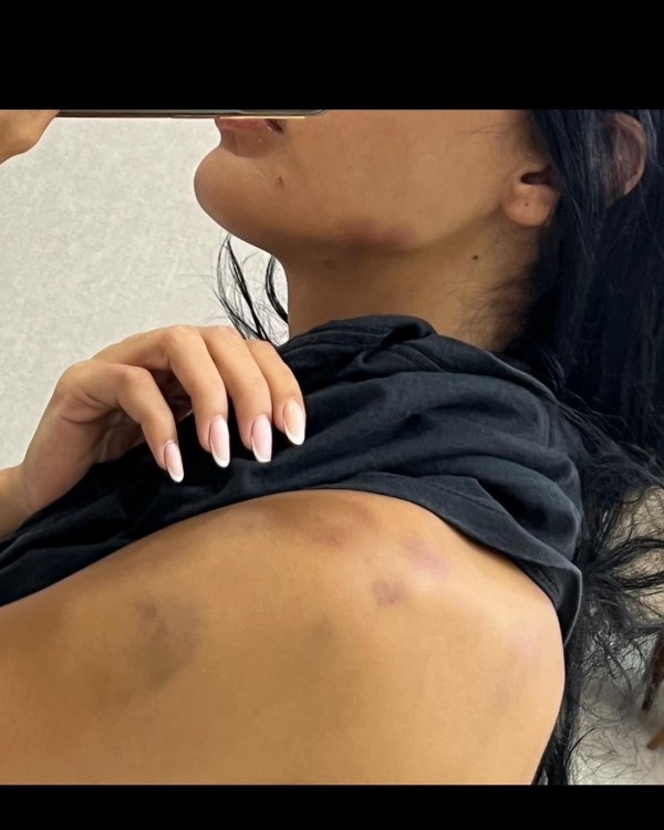 "Məni 13-cü mərtəbədən atmağa cəhd edirdi"  - Model (FOTO)