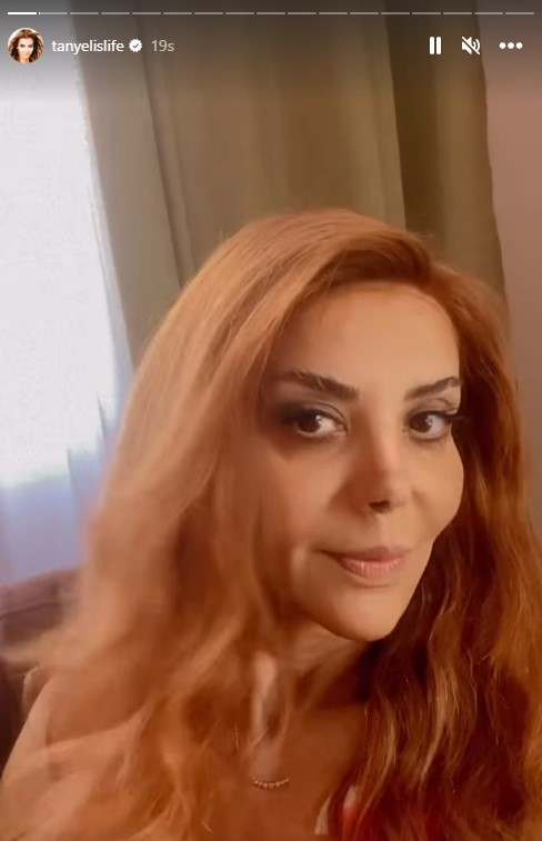 Xərçəng olan rəqqasə saçlarını kəsdirdi - VİDEO