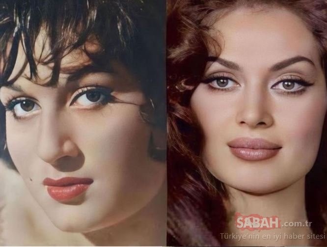 Türkan Şoray yenə estetik əməliyyatı ilə gündəmə gəldi - FOTOLAR